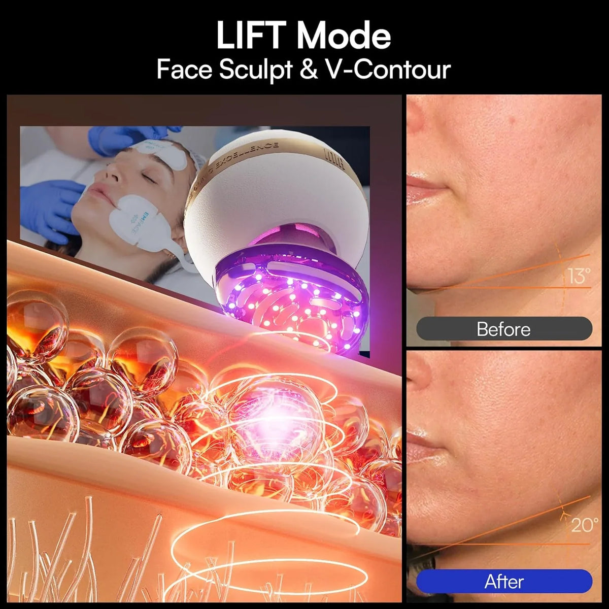 INIA SPHERA Upgraded 8-in-1 Microcurrent Facial Device for Face & Neck Red Light